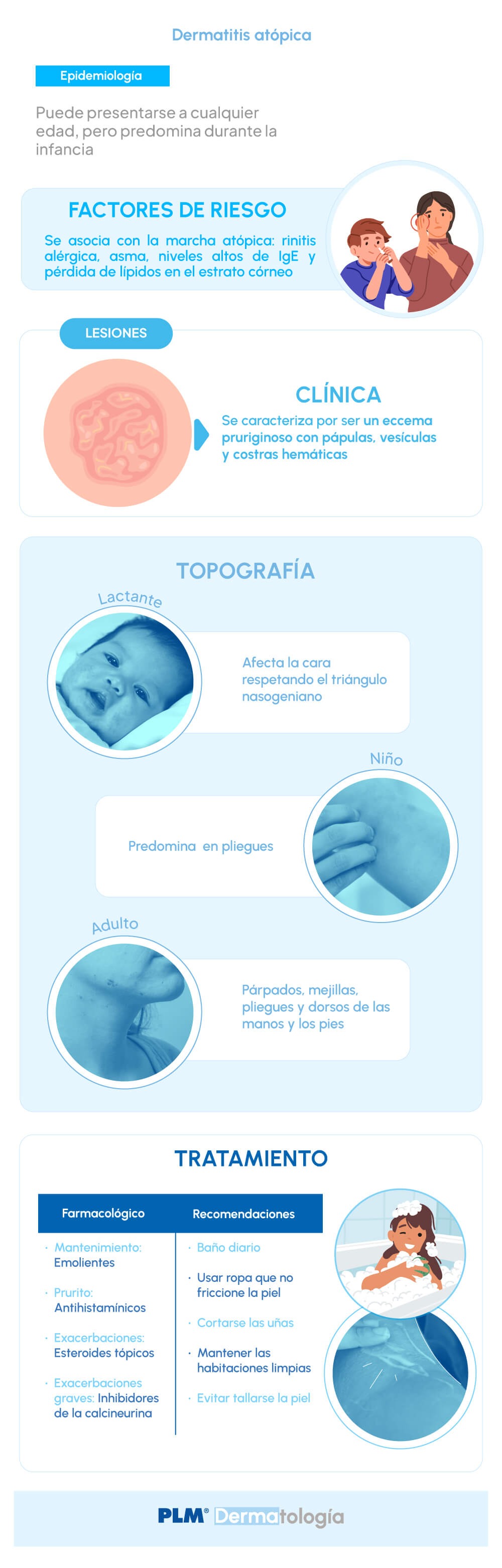 Dermatitis atópica