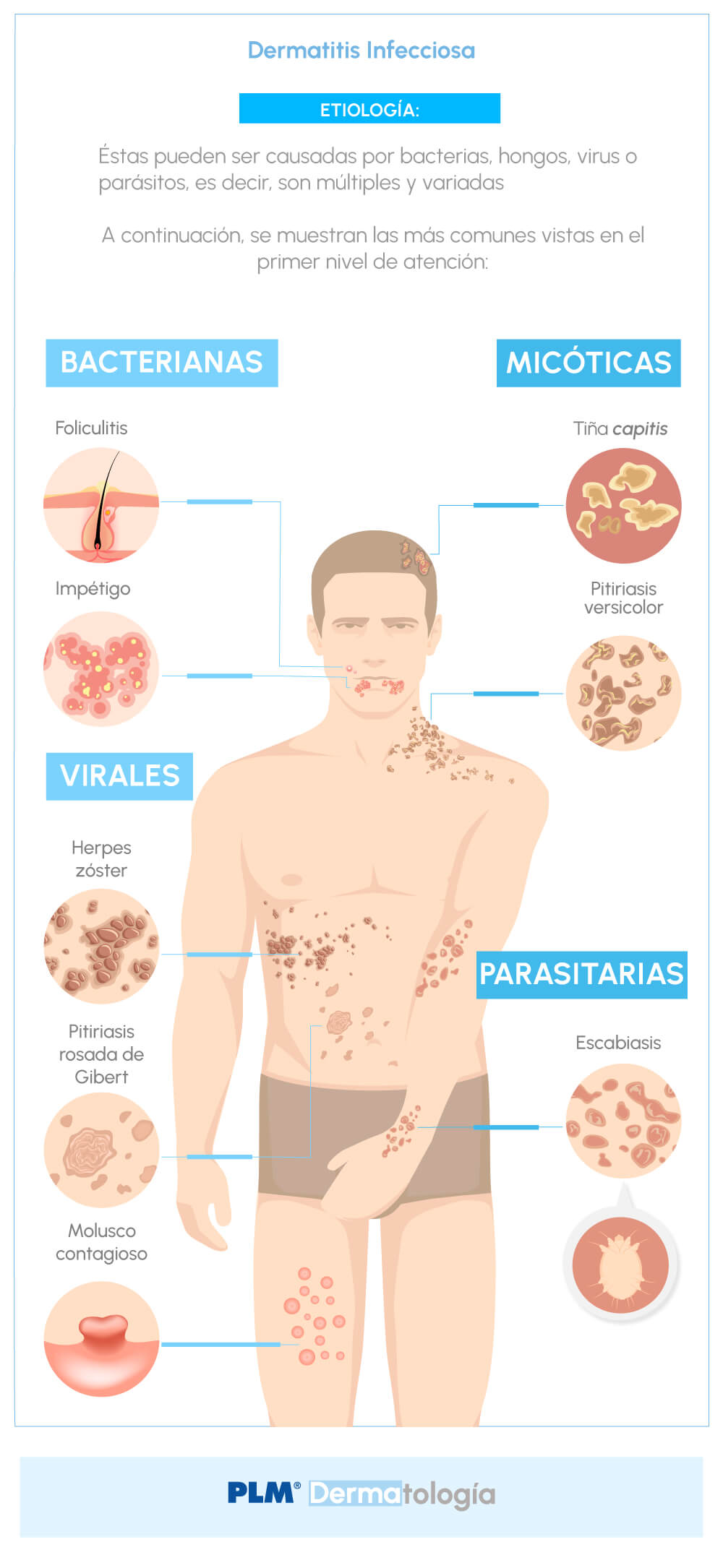 Dermatitis infecciosa