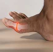 Hiperuricemia y gota